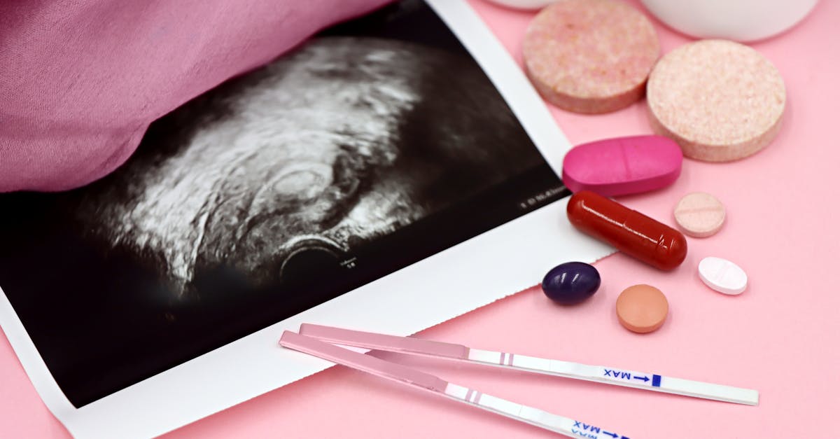 découvrez notre sélection de suppléments de fertilité pour soutenir votre santé reproductive. formulés pour favoriser l'équilibre hormonal et maximiser vos chances de conception, nos produits naturels vous accompagnent sur le chemin de la parentalité.
